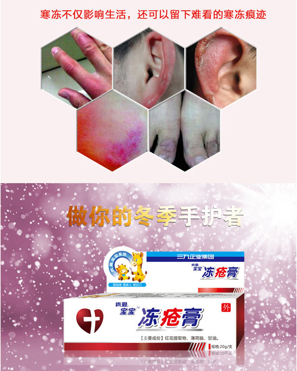 肯愛(ài)凍瘡膏產(chǎn)品展示.jpg