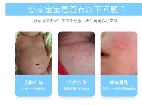 寶寶肌膚常見(jiàn)問(wèn)題.jpg 寶寶肌膚常見(jiàn)問(wèn)題.jpg